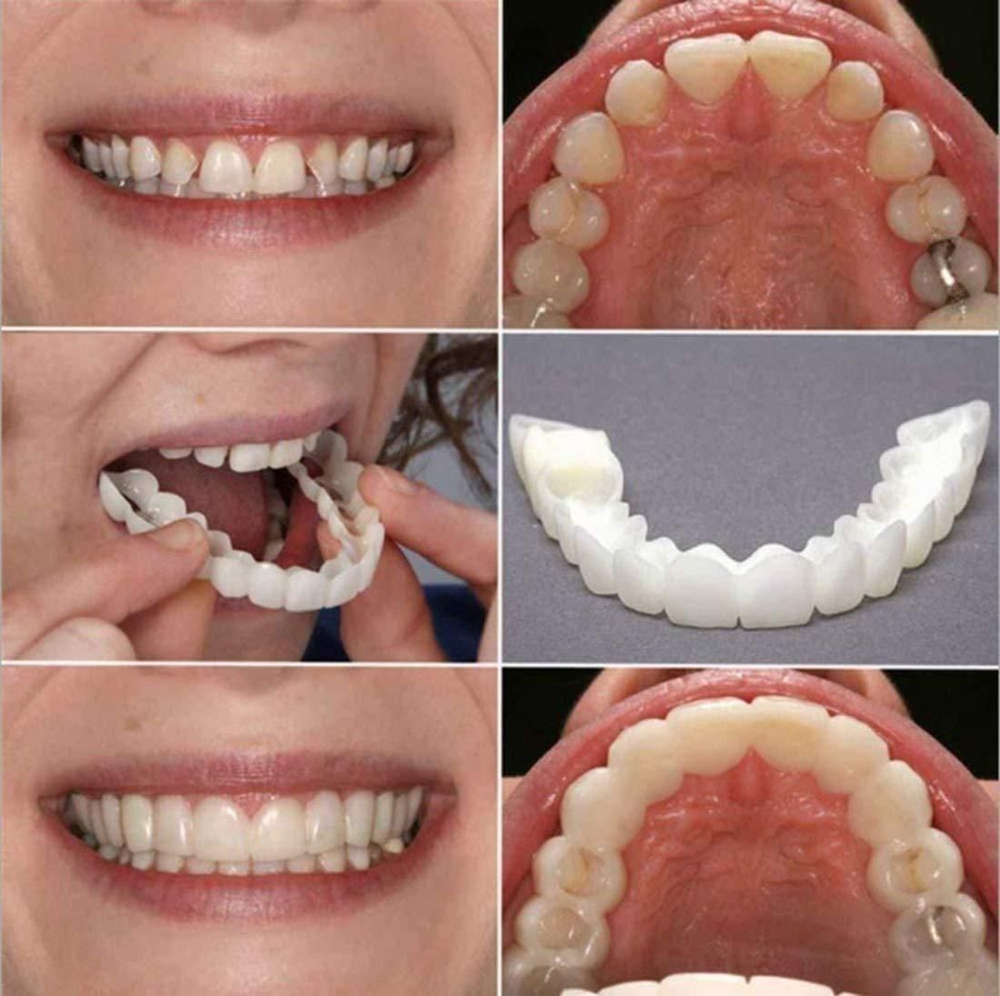 🌟 FitFlex™ Instant Smile Veneers 😁 Buy 1 Get 1 FREE | Snap-On Smile | No Dentist Needed! ⭐⭐⭐⭐⭐ 4.9/5.0 ❤️ 10,000+ Verified Buyers