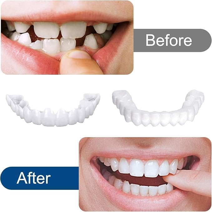 🌟 FitFlex™ Instant Smile Veneers 😁 Buy 1 Get 1 FREE | Snap-On Smile | No Dentist Needed! ⭐⭐⭐⭐⭐ 4.9/5.0 ❤️ 10,000+ Verified Buyers