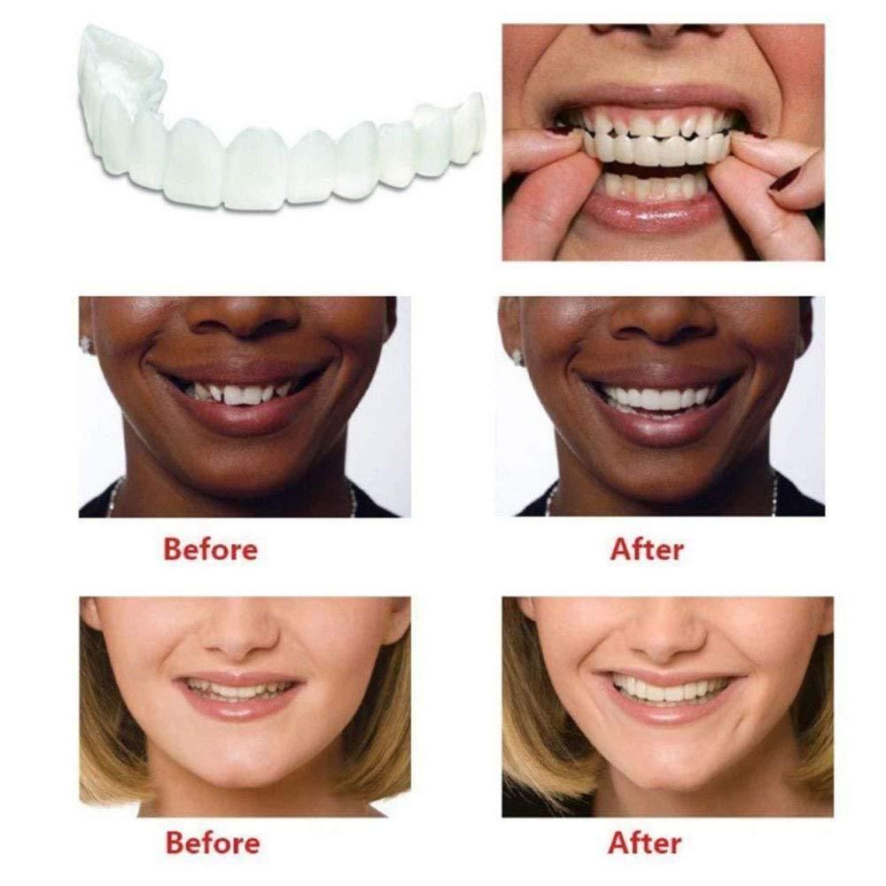 🌟 FitFlex™ Instant Smile Veneers 😁 Buy 1 Get 1 FREE | Snap-On Smile | No Dentist Needed! ⭐⭐⭐⭐⭐ 4.9/5.0 ❤️ 10,000+ Verified Buyers
